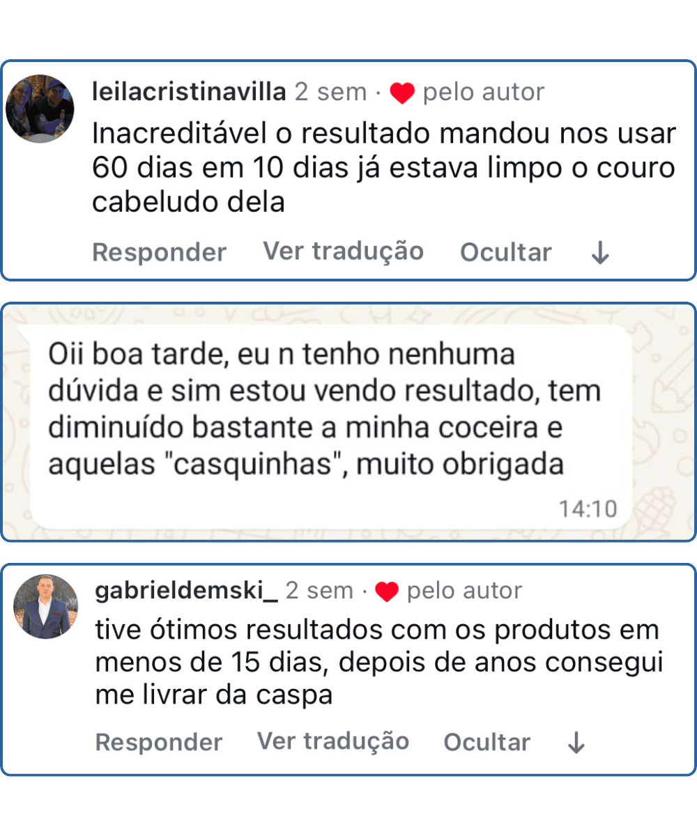 Depoimento Kit Scalp Care 1